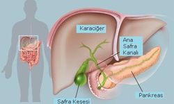 “Safra kesesi taşları hayatı risk oluşturur