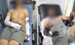 Sanayi sitesinde patlama: 2 yaralı