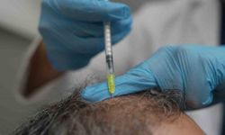 Dökülen saçlar vücudun bir alarmı olabilir