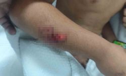 Köpek saldırısına uğrayan çocuğun başına 15 dikiş atıldı
