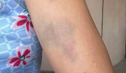 ‘Sokak köpeklerini besledin’ dayağı iddiası