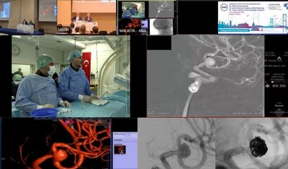 Canlı yayında zorlu beyin ameliyatı