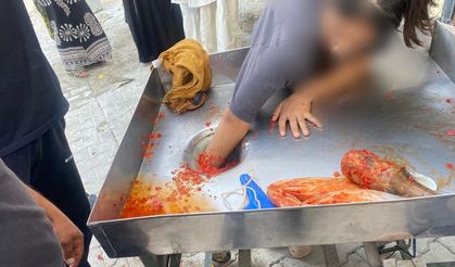 Kız çocuğu elini salça makinesine kaptırdı