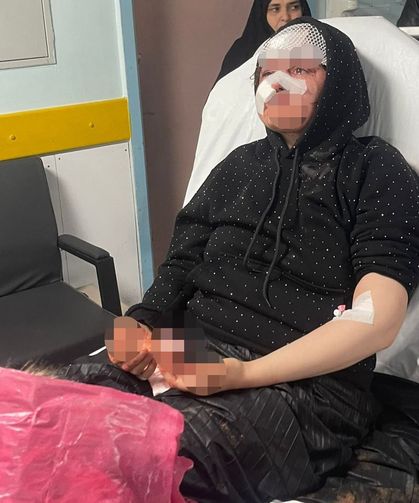 Boşanmak isteyen kadın eşi tarafından öldüresiye darp edildi