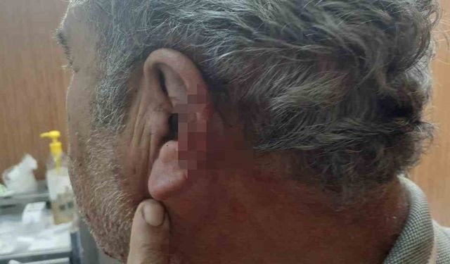 Doktor ile emekli öğretmenin mesai kavgası karakolda bitti