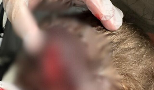 Anne ve çocuk ölümden döndü! Sahipli köpek d*hşet saçtı