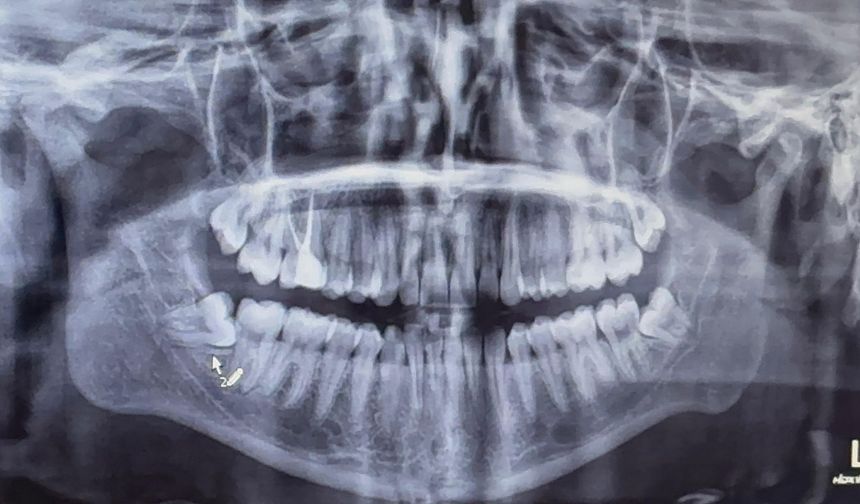 Niğde’de ortodontide özel kliniğe sevk dönemi başladı