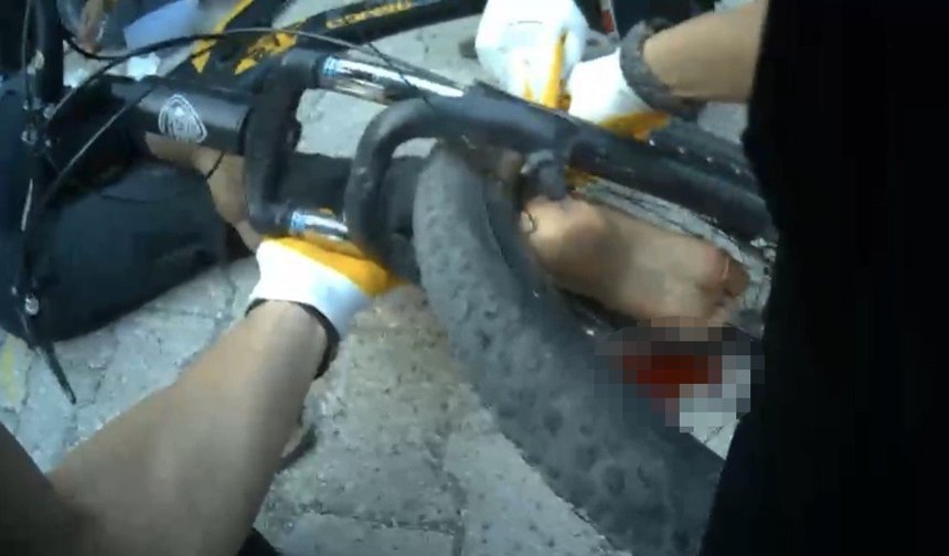 Ayağı bisikletin tekerine sıkışan çocuk ekiplerce kurtarıldı